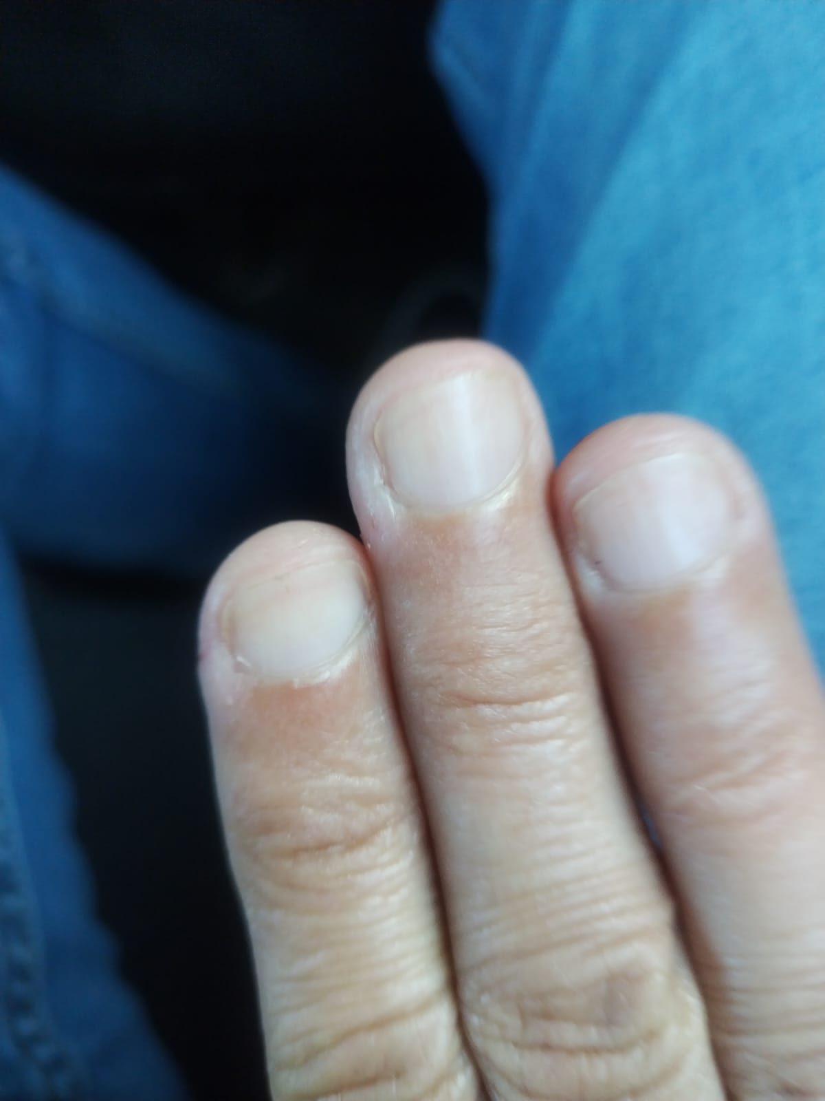 Anxiété sociale thérapie réussie Paris